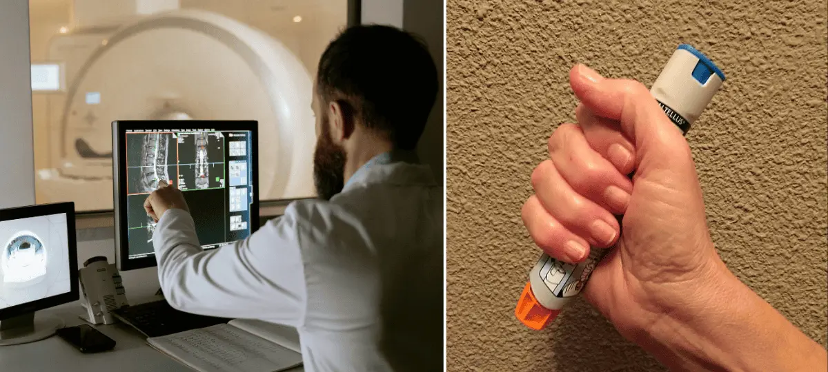 CT, epipen, alergia, smrť