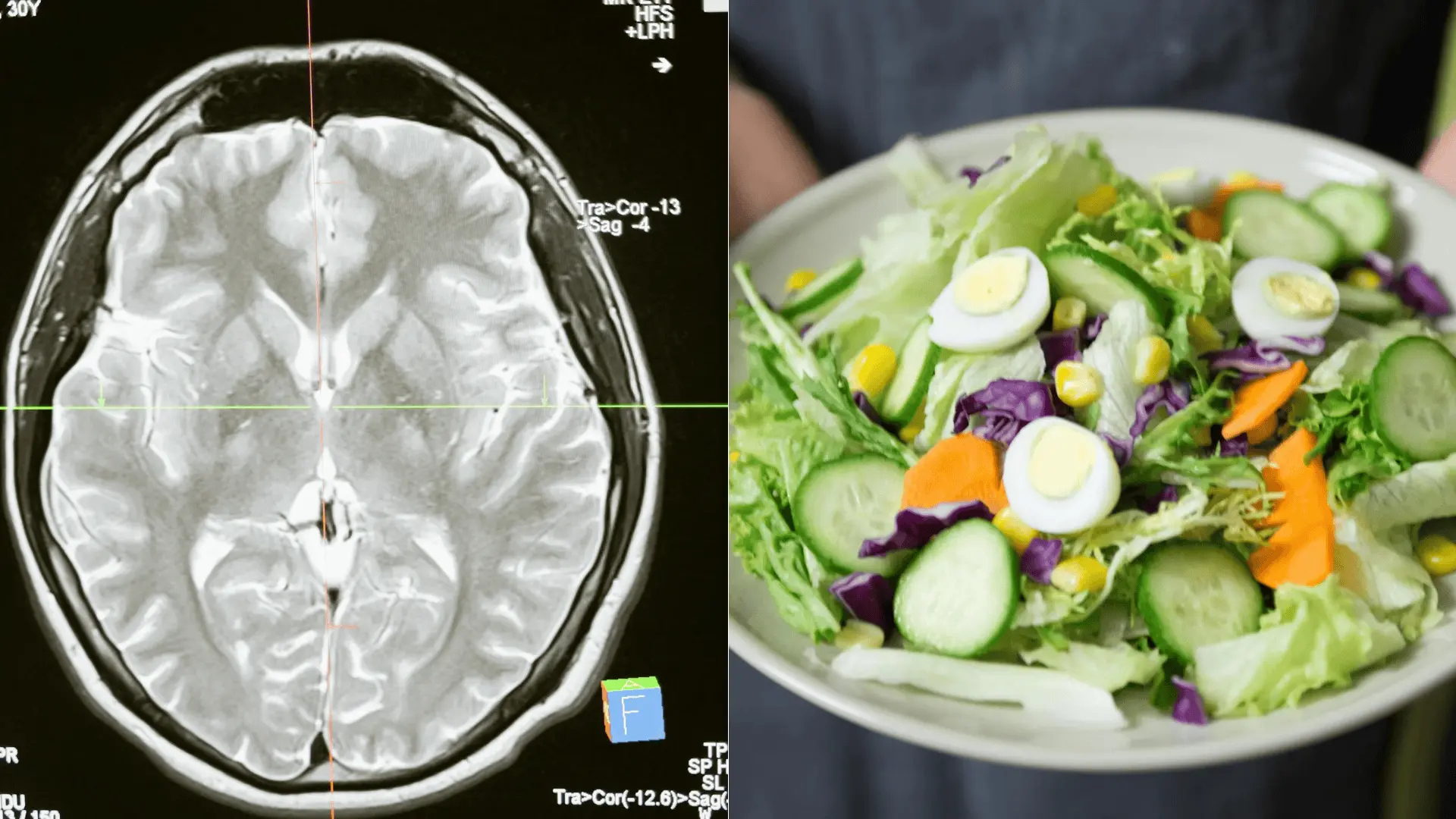 mozog črevá strava zdravie