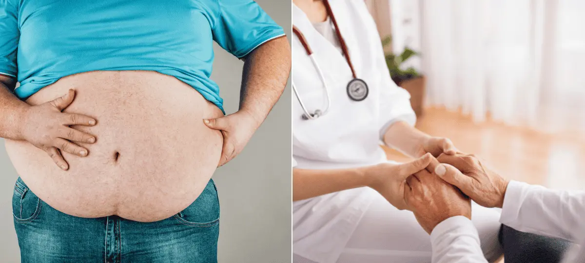 obezita, zdravie, lekár