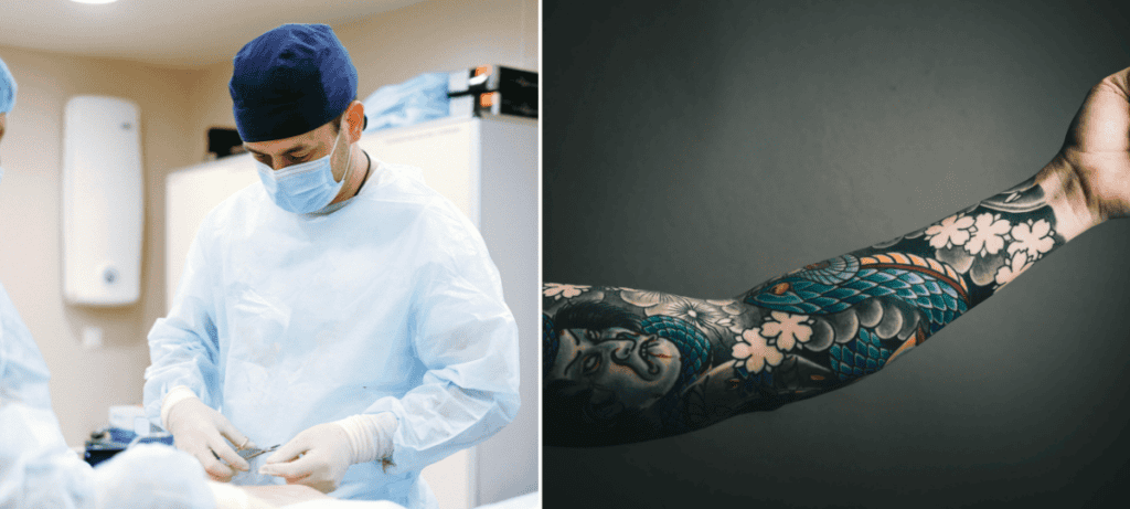 chirurg, tetovanie