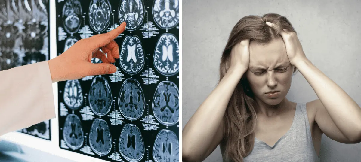 aneuryzma, príznaky