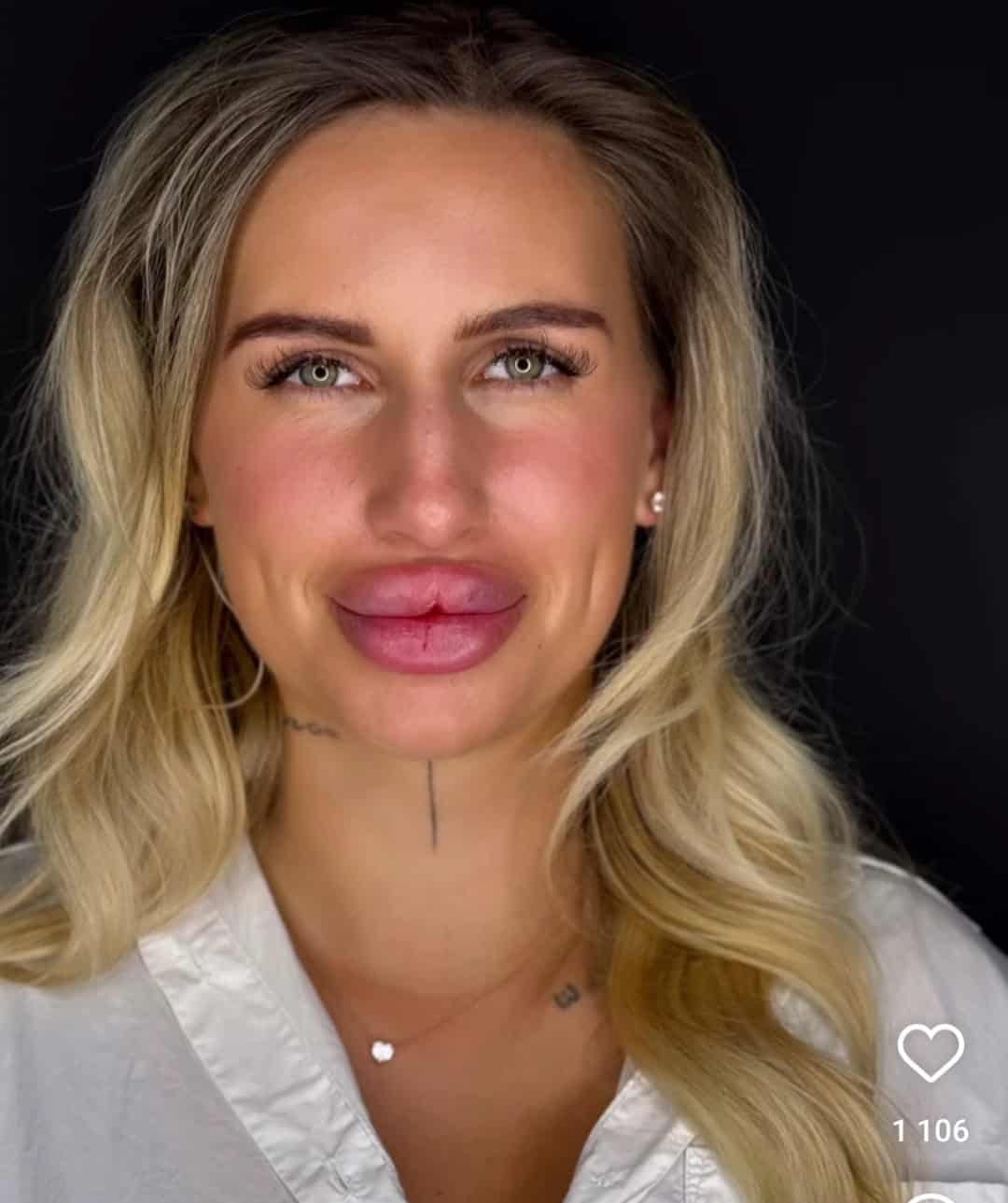 Lindita