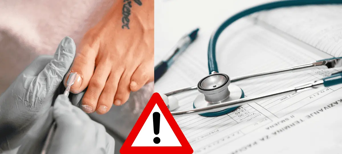 rakovina, necht, diagoza