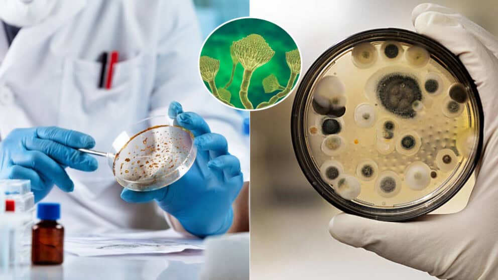 Huba Aspergillus