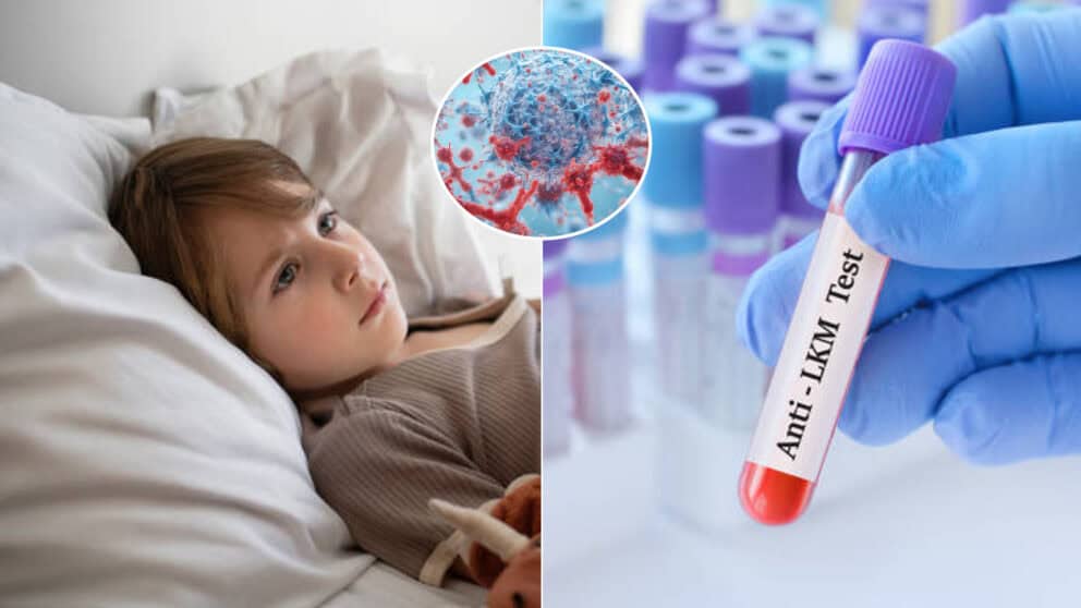 hepatitída