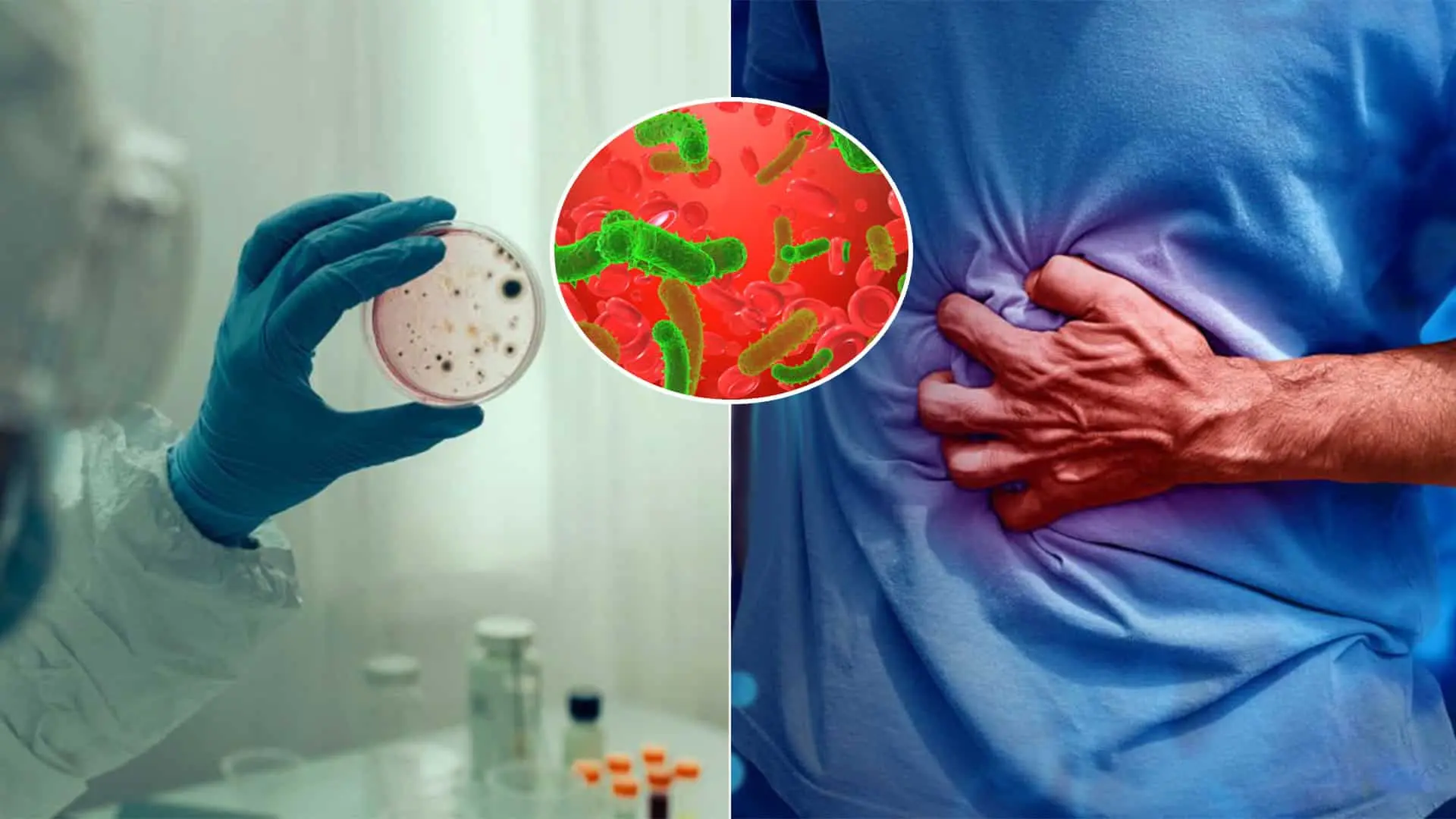 cholera nákaza bolesť brucha