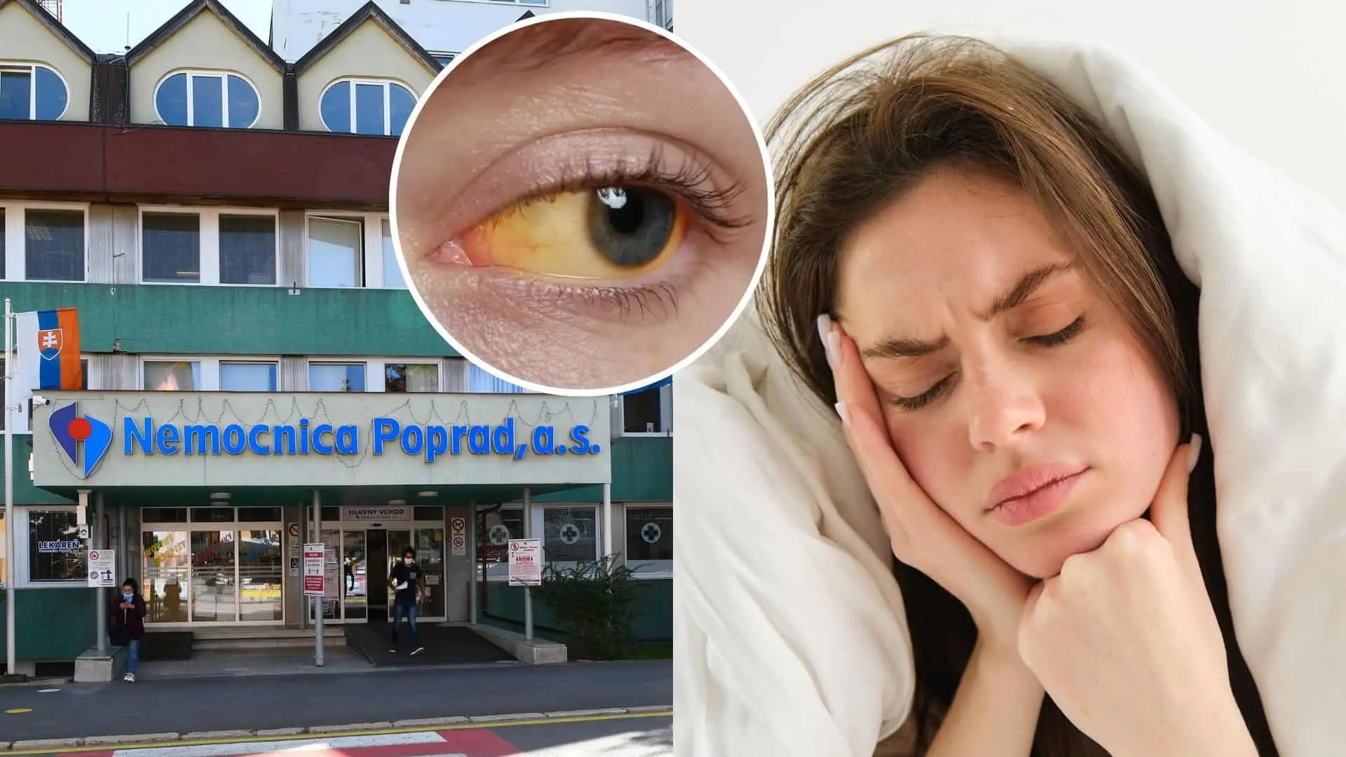 Popradskú nemocnici trápi žltačka typu A. Zdroj: TASR/Milan Kapusta, Freepik