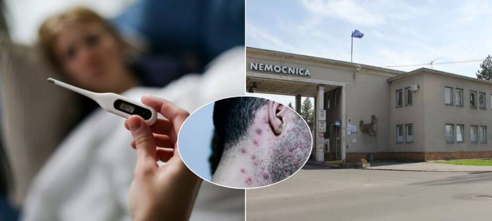 nemocnica, horúčka q