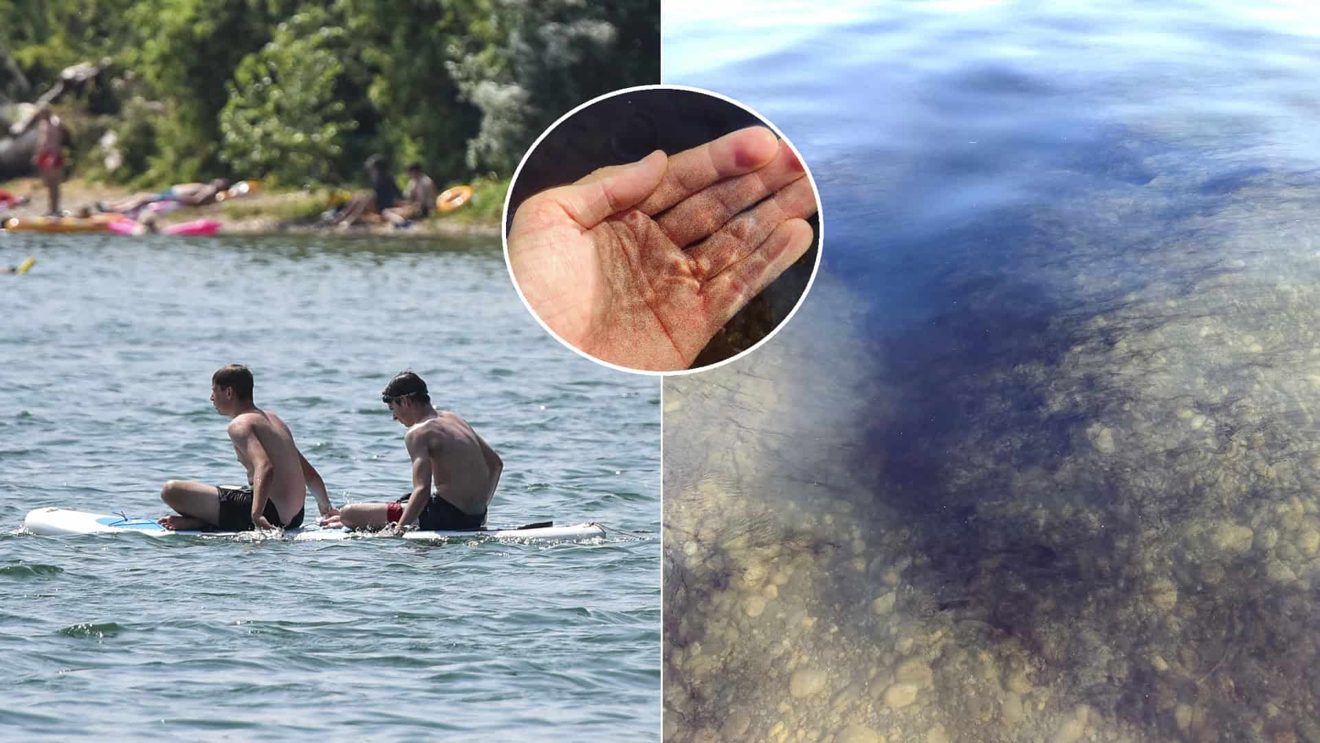 kúpanie Vajnorské jazero výskyt Stentora amethystinus alebo tzv. nálevníka.