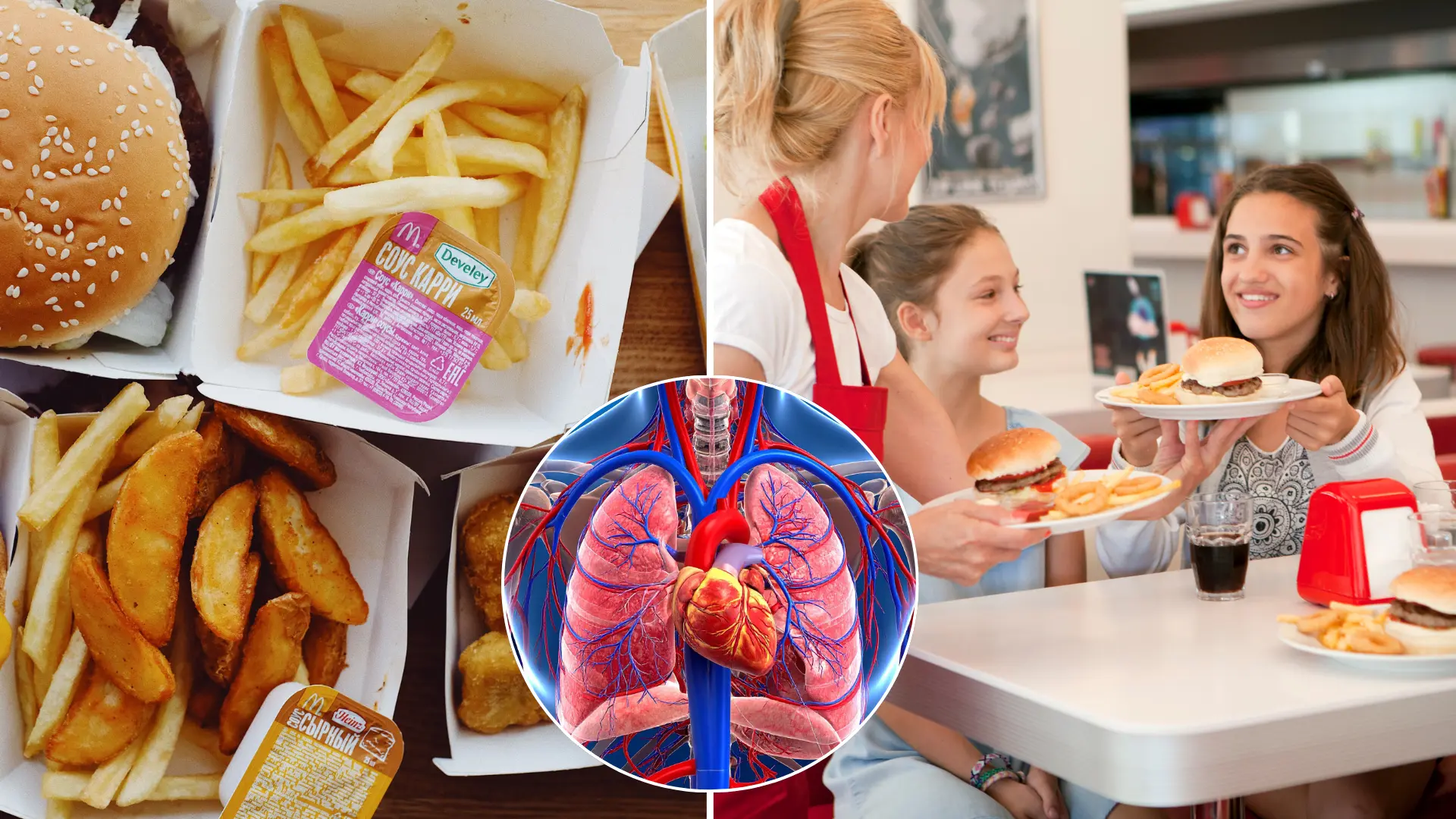 fast food, zdravie
