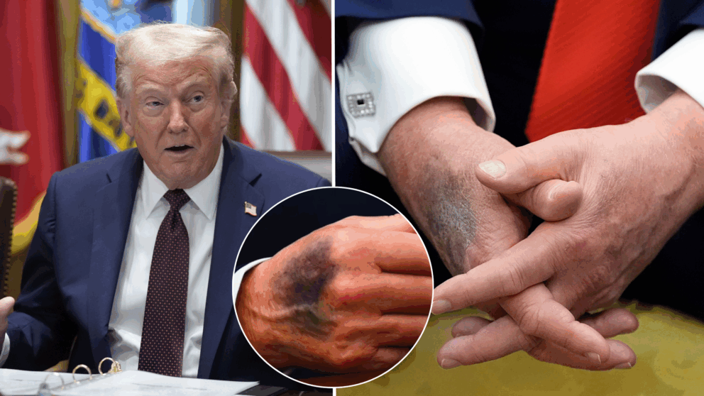 Trump, zdravie