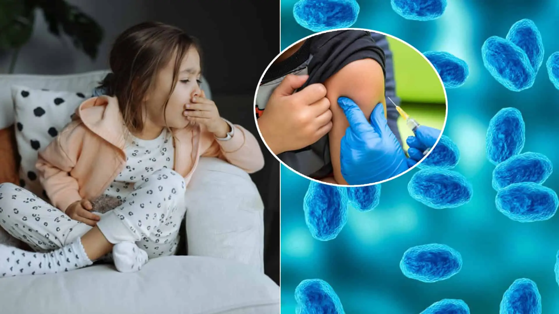 čierny kašeľ dieťa očkovanie