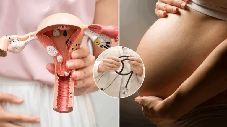 maternica, transplantácia