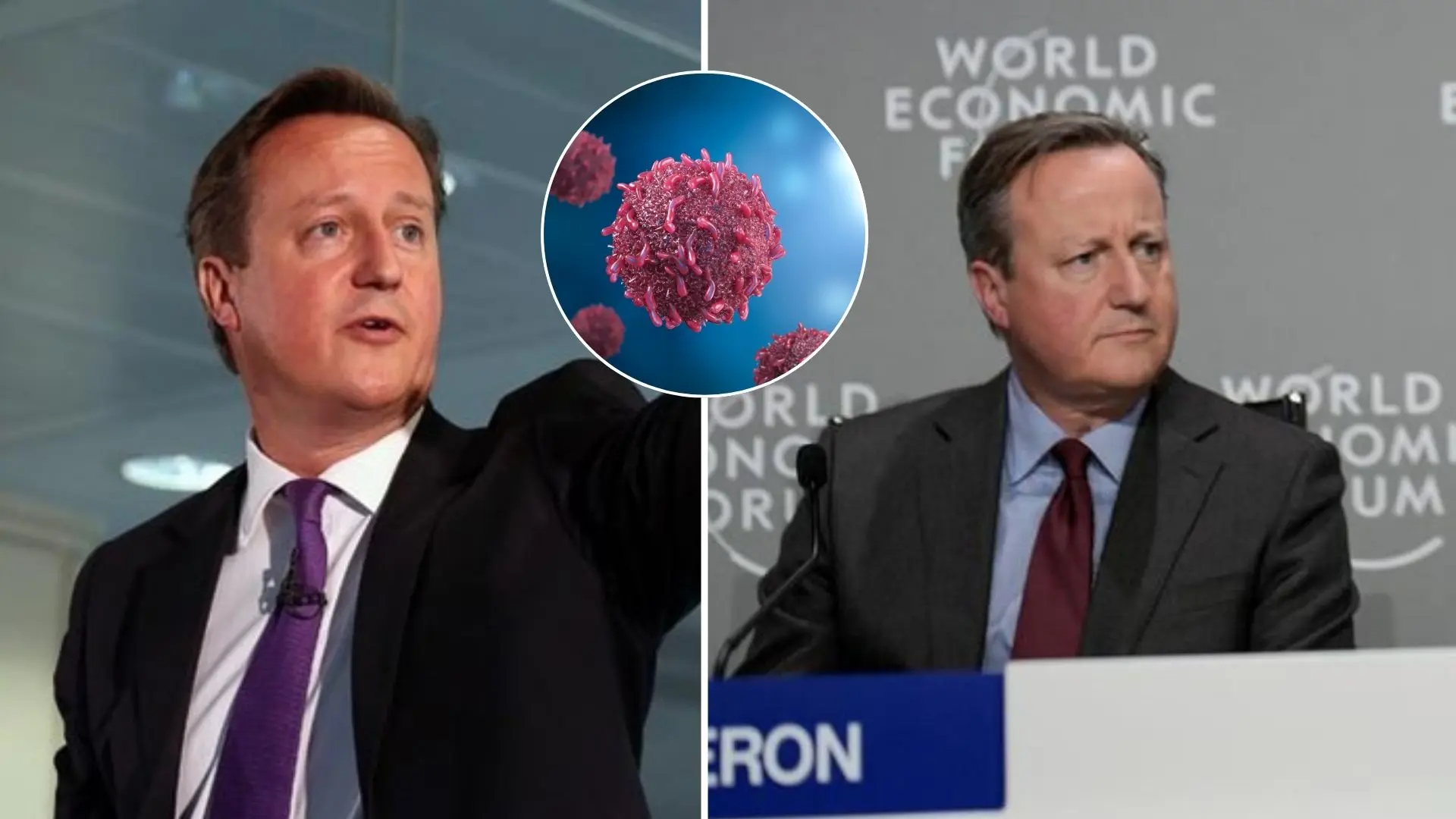 David Cameron, rakovina