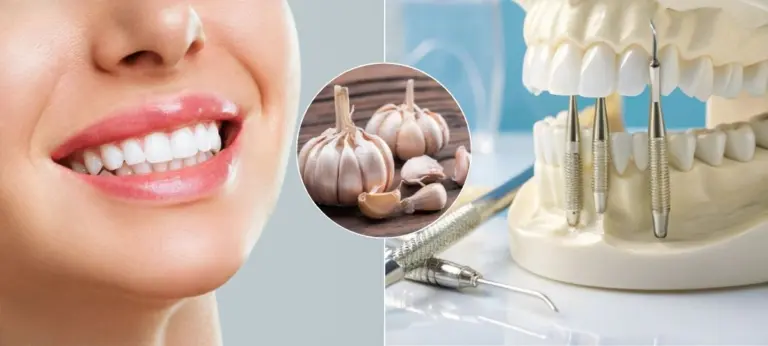 zuby, ústna hygiena, cesnak