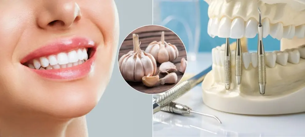 zuby, ústna hygiena, cesnak