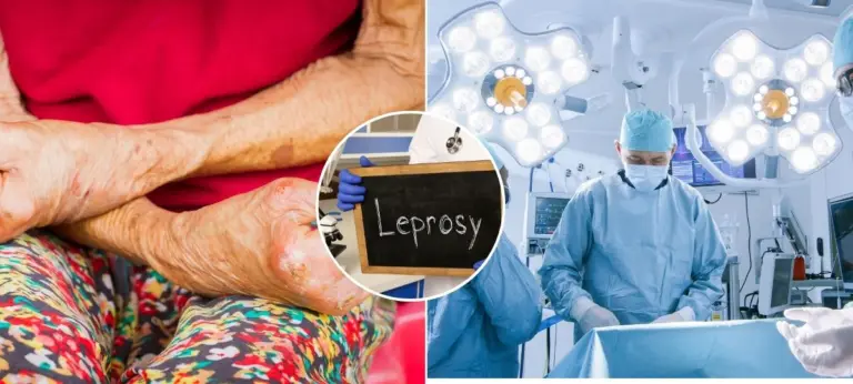 lepra