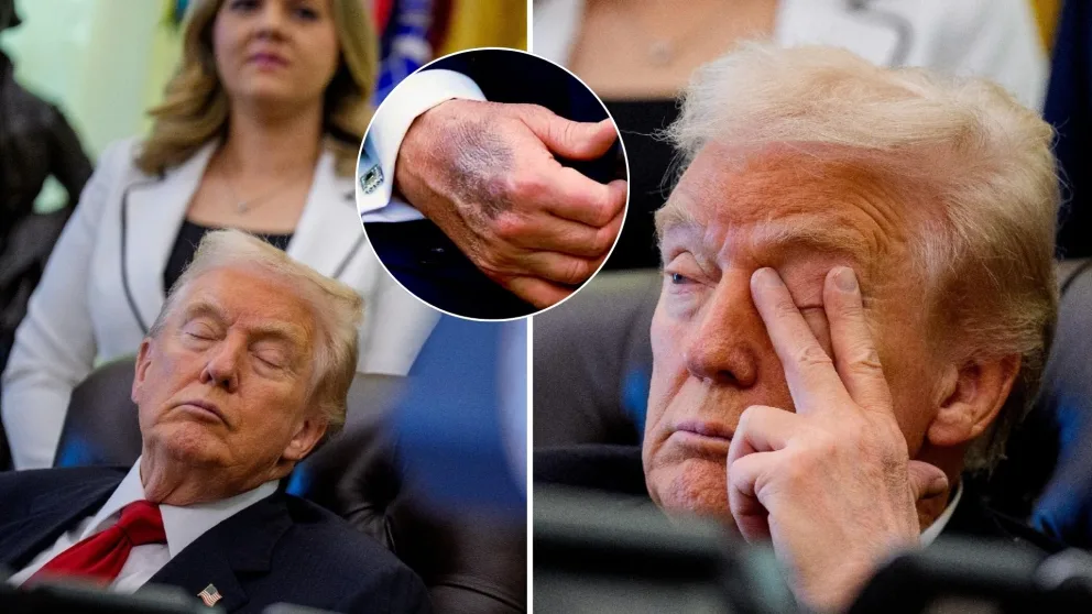 Trump, spánok, šlofík