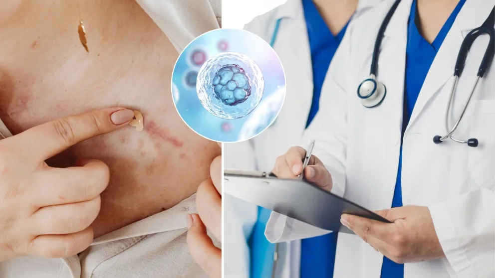 jazvy, bunky, hojenie