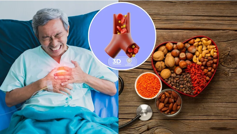 Výskumníci vyvinuli špeciálne cestoviny, ktoré v klinickej štúdii preukázali súvislosť so znižovaním hladiny LDL cholesterolu.